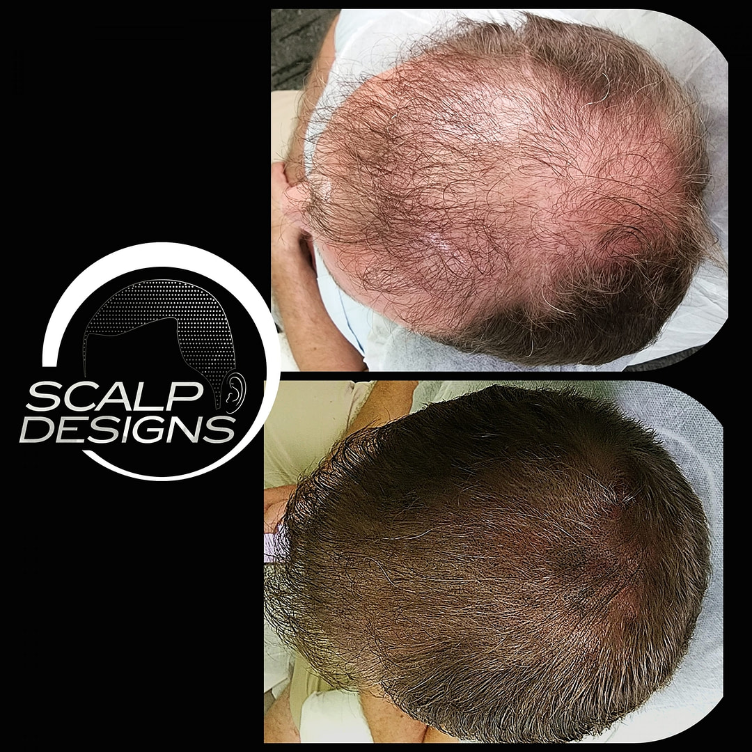 smp long hair thinning fill in