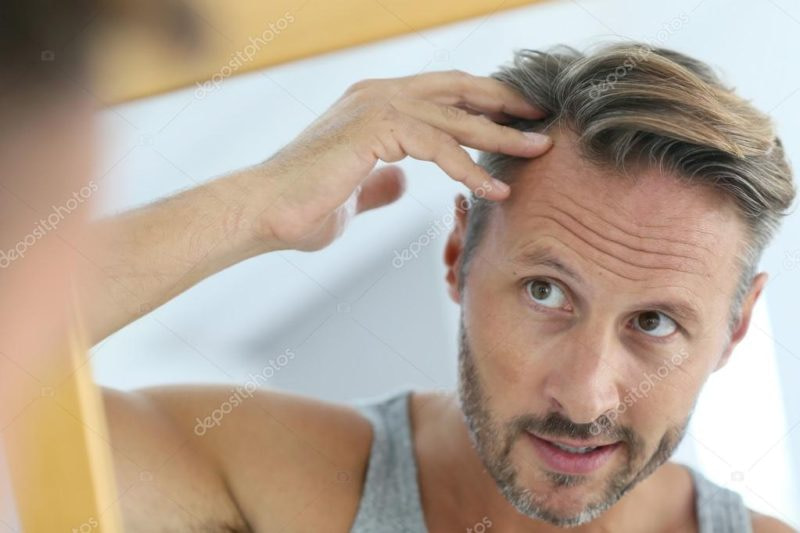 man with hair loss