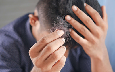 Is Hair Loss Preventable? How to Minimize Your Risk