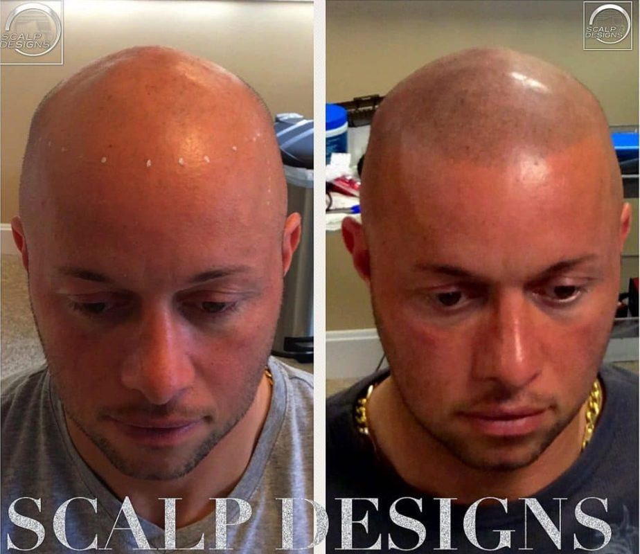 scalp designs client 